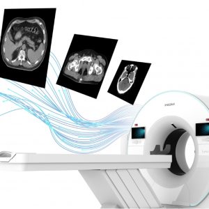 TurboTom 3S Series – Hệ thống CT Helical 64 lát cắt sử dụng AI